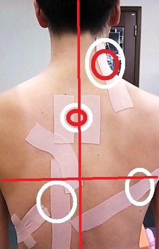 体幹筋膜／人間